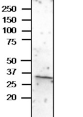 CLO3 | Caleosin-3 in the group Antibodies Plant/Algal / Environmental Stress / Drought stress at Agrisera AB (Antibodies for research) (AS20 4418)